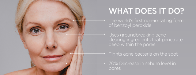 17oils Acne Control Serum 1oz