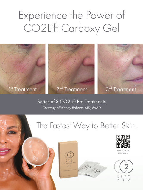 The CO2 Lift Pro Facial