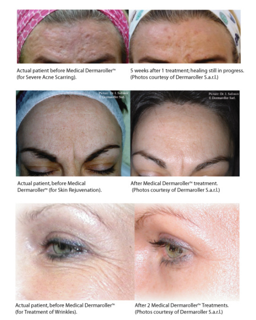 AntiAging CIT Facial