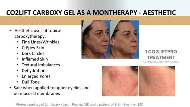 CO2 Lift Pro Dermablading Facial