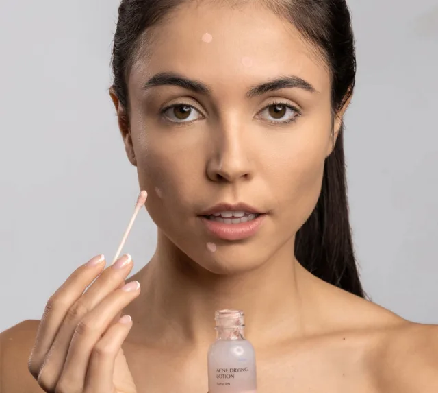 17oils HealsIt Acne Drying Serum