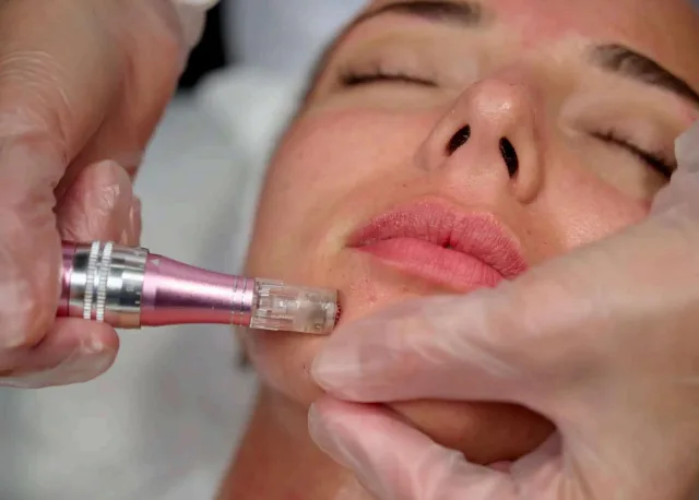 Series of 3 Exosomes Facials