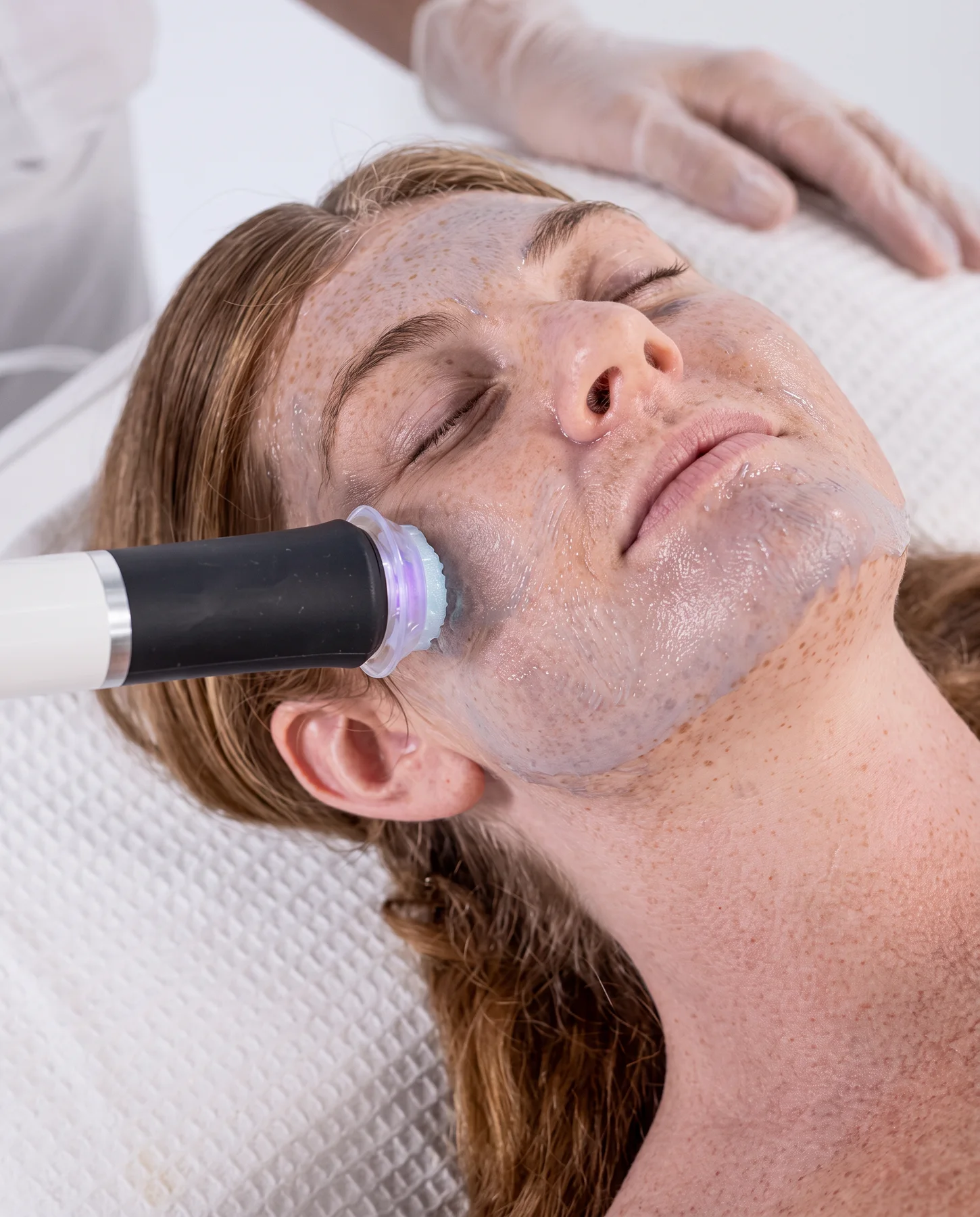 Guest resting on the treatment table at ESSpa while a handheld exfoliating device glides gently across the cheek during a resurfacing facial
