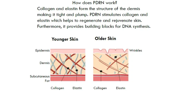 Full Series of 3 Salmon PDRN Facial Treatments