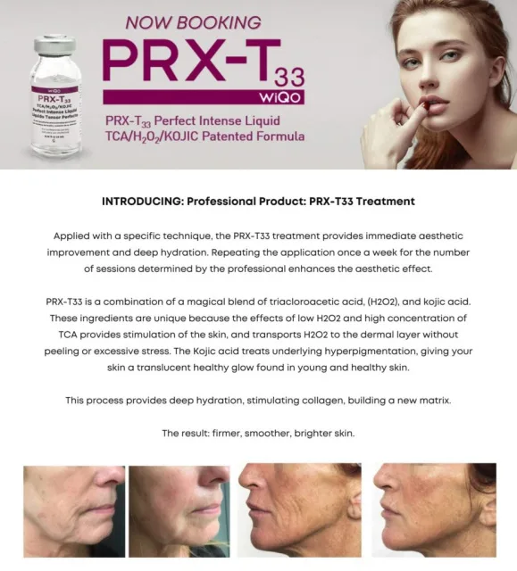WiQo T33 Italian Peel Facial (Single)